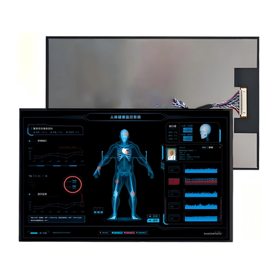 10.1-inch TFT-LCD-scherm - High-Res touchscreen voor industrieel en automobiel gebruik
